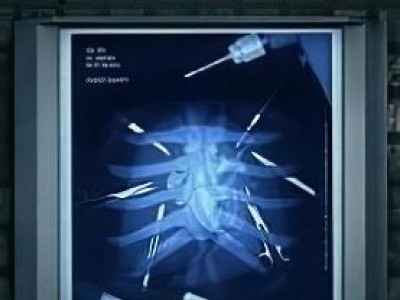 Surgeon Simulator Experience Reality